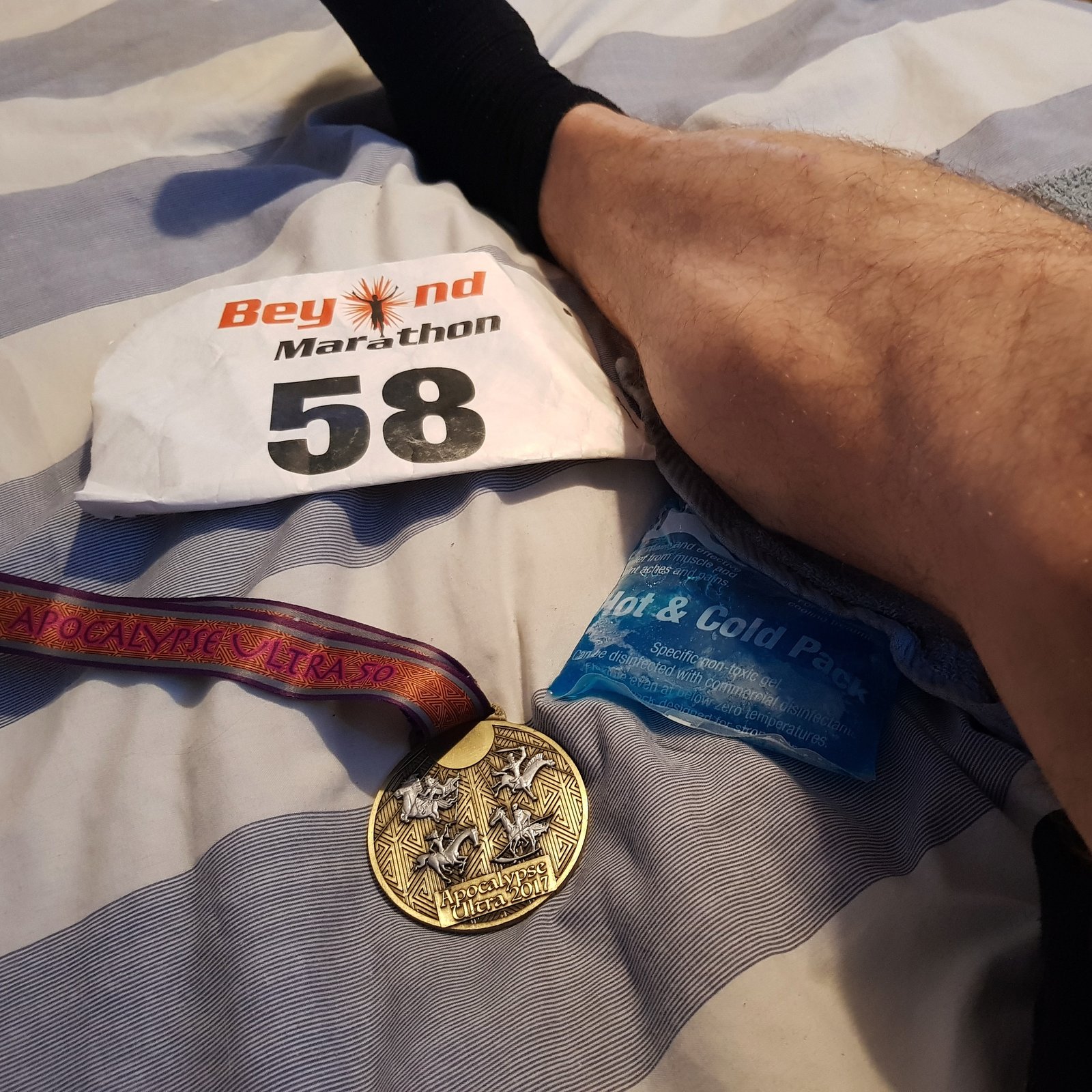 Swollen Calf and Finishers Medal